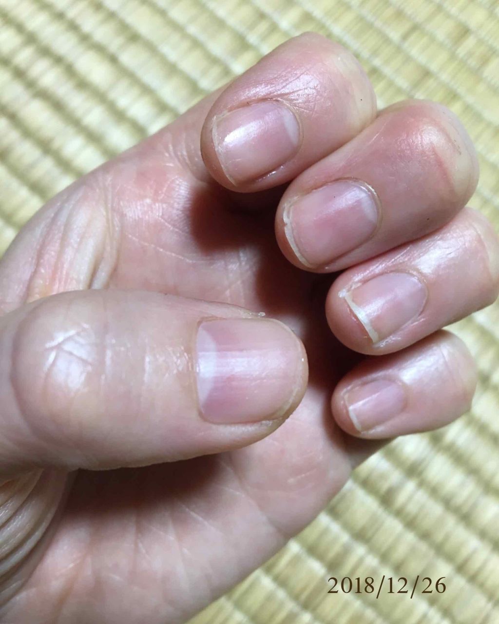 ネイルトリートメント R/ネイルネイル/ネイルオイル・トリートメントを使ったクチコミ(4枚目)