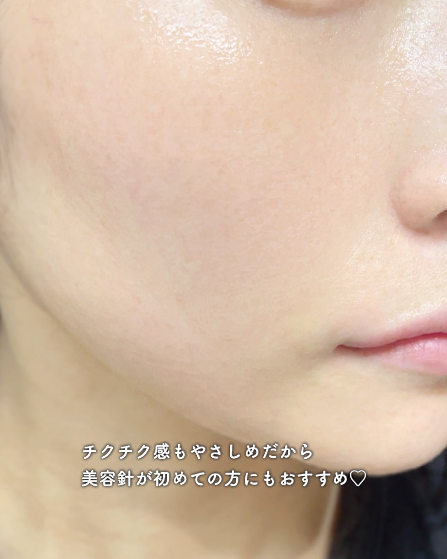 パンテショット675/COSNORI/美容液を使ったクチコミ(5枚目)