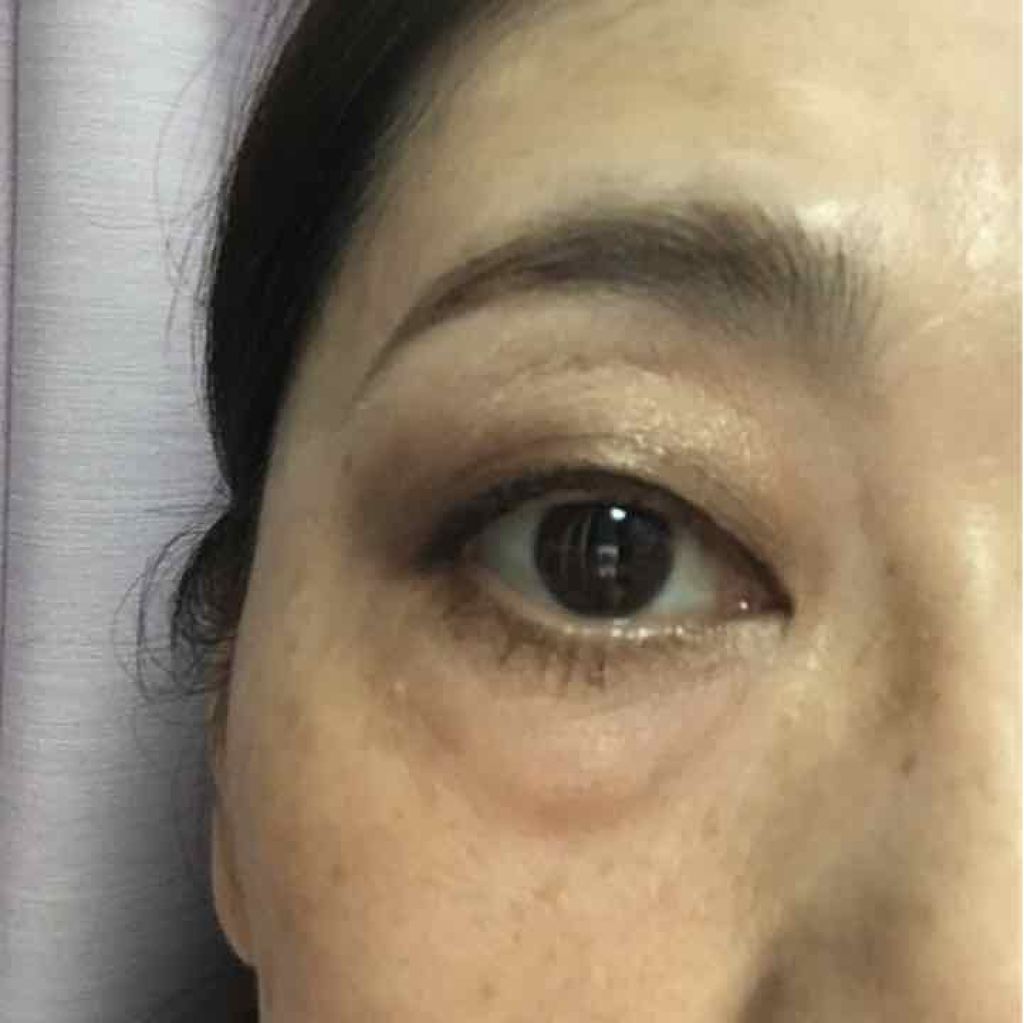 オンブル プルミエール トップコート/CHANEL/単色アイシャドウを使ったクチコミ（2枚目）