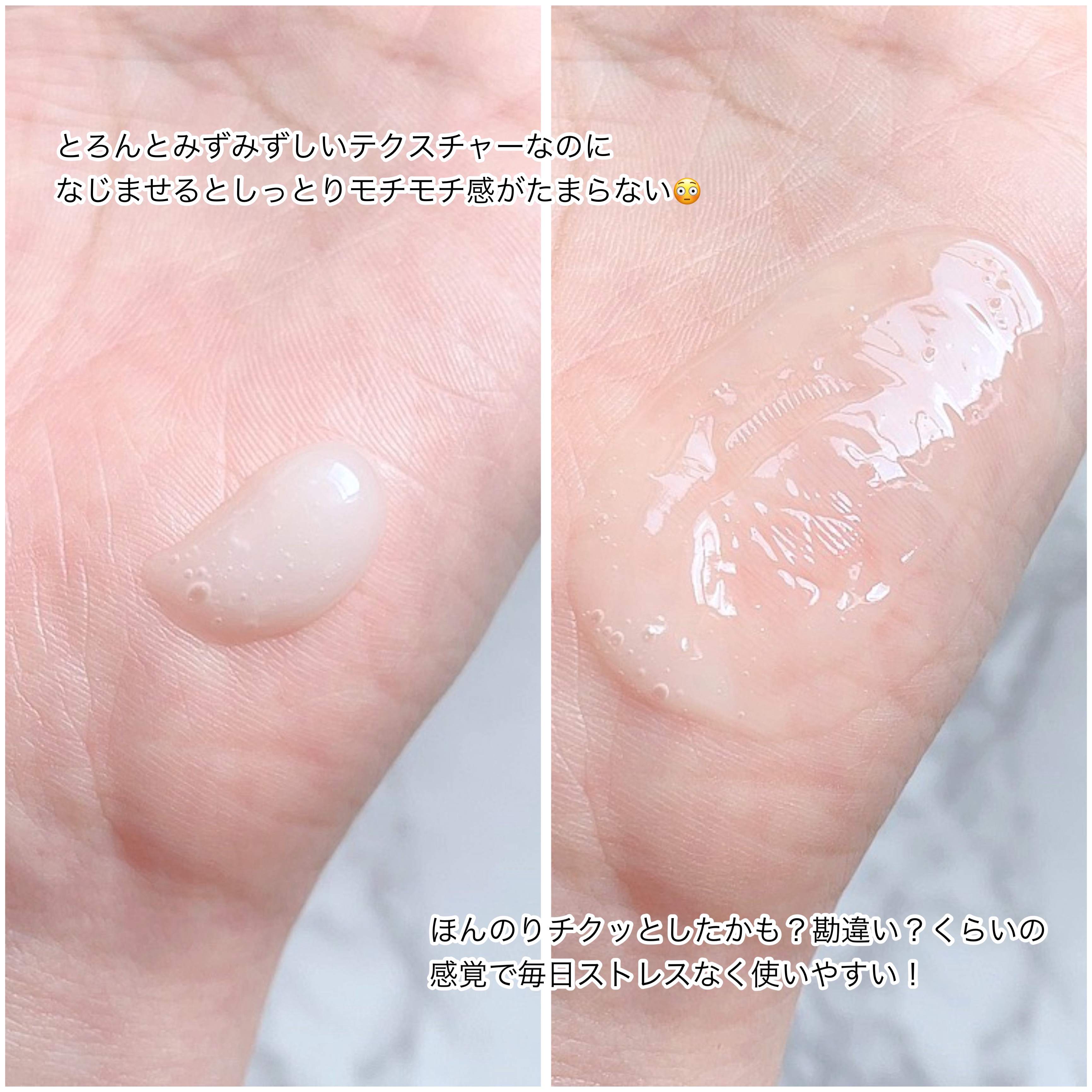 ビディ ニードルエッセンス NN/ビディ/美容液を使ったクチコミ（3枚目）