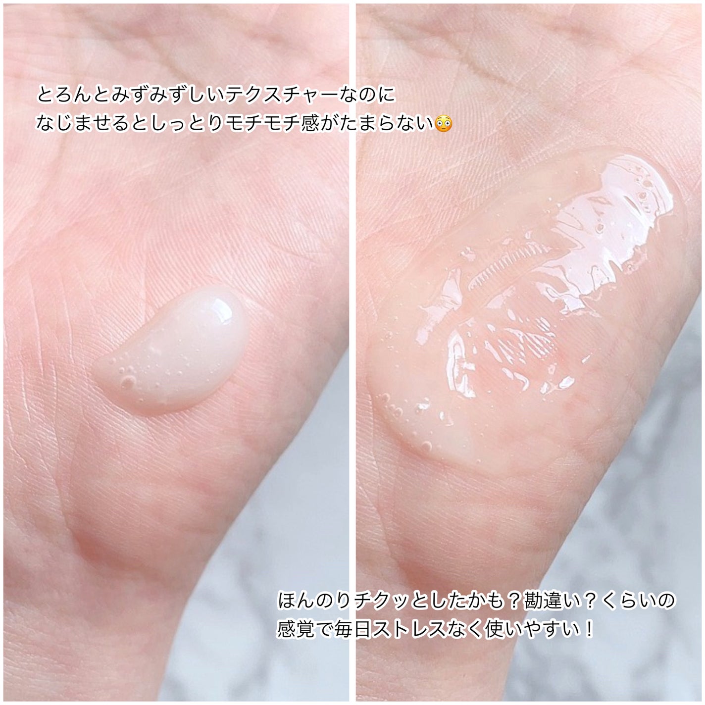 ビディ ニードルエッセンス NN/ビディ/美容液を使ったクチコミ(3枚目)