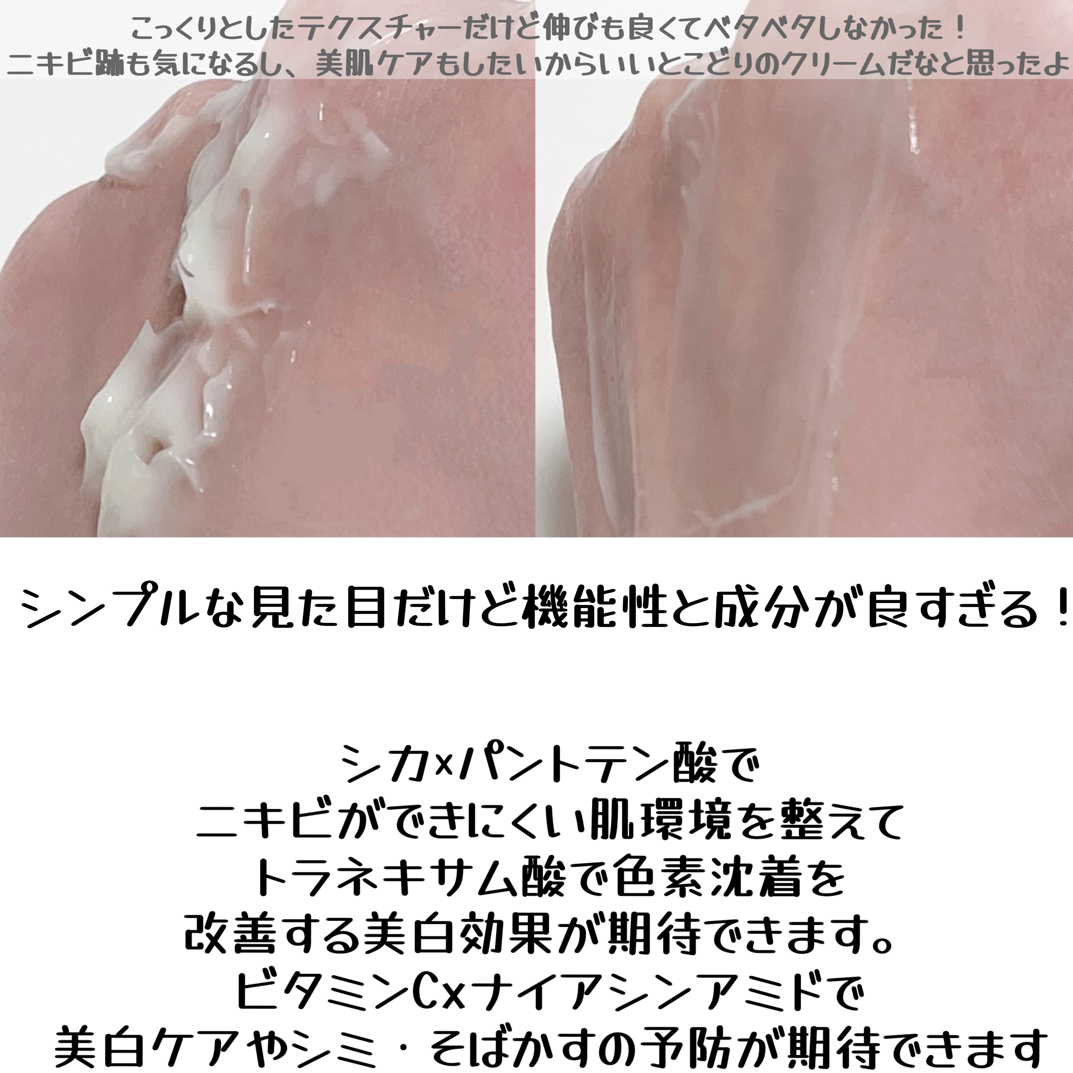 レッドブレミッシュ リペアスージングクリーム/Dr.G/フェイスクリームを使ったクチコミ（3枚目）