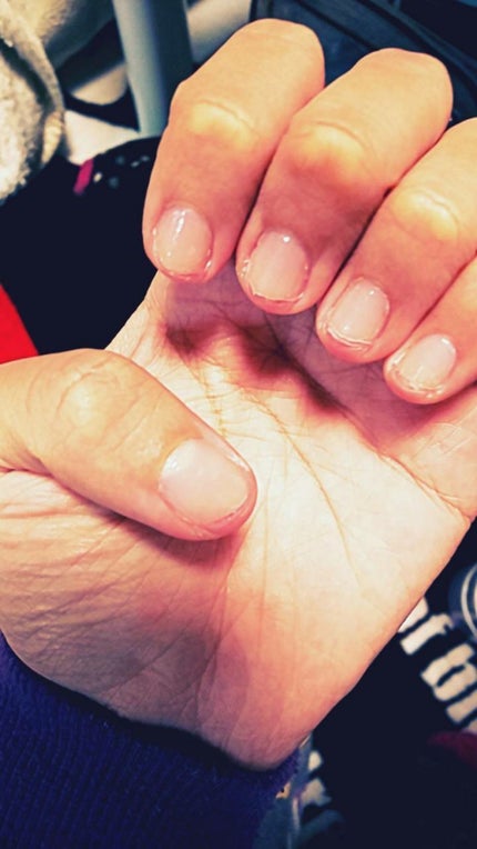 ネイルベッドオイル/アンドネイル/ネイルオイル・トリートメントを使ったクチコミ(1枚目)