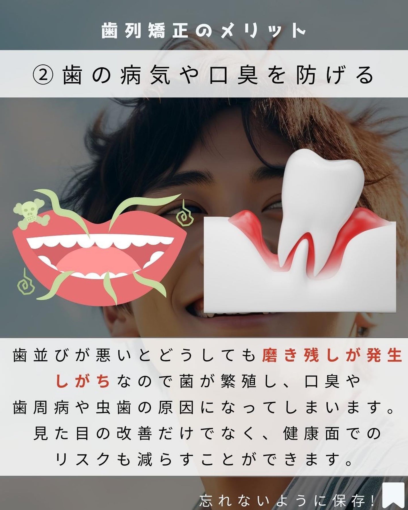 ヨウ | 31歳の老けない暮らし on LIPS 「今回は歯列矯正のメリット、注意点をご紹介します。僕は元々歯並び..」(4枚目)