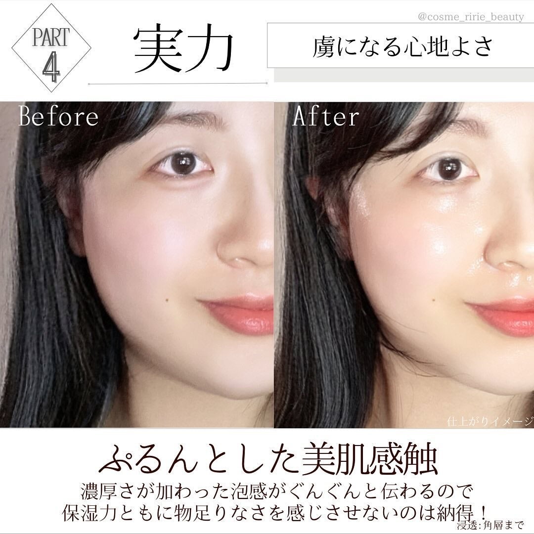 マイクロバブルVC10セラム/DSW/美容液を使ったクチコミ(6枚目)