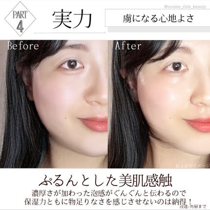 マイクロバブルVC10セラム/DSW/美容液を使ったクチコミ(6枚目)