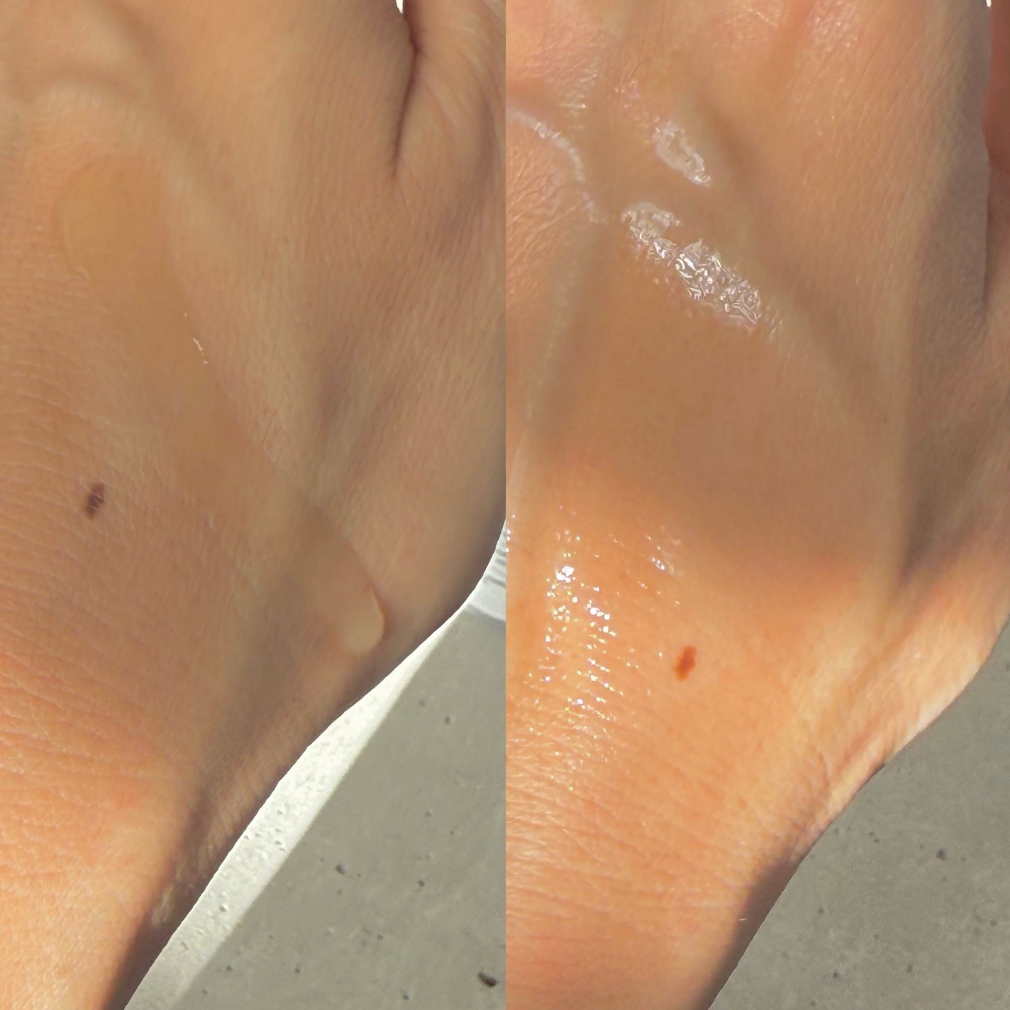 CGトーニングセラム/ilso/美容液を使ったクチコミ(4枚目)