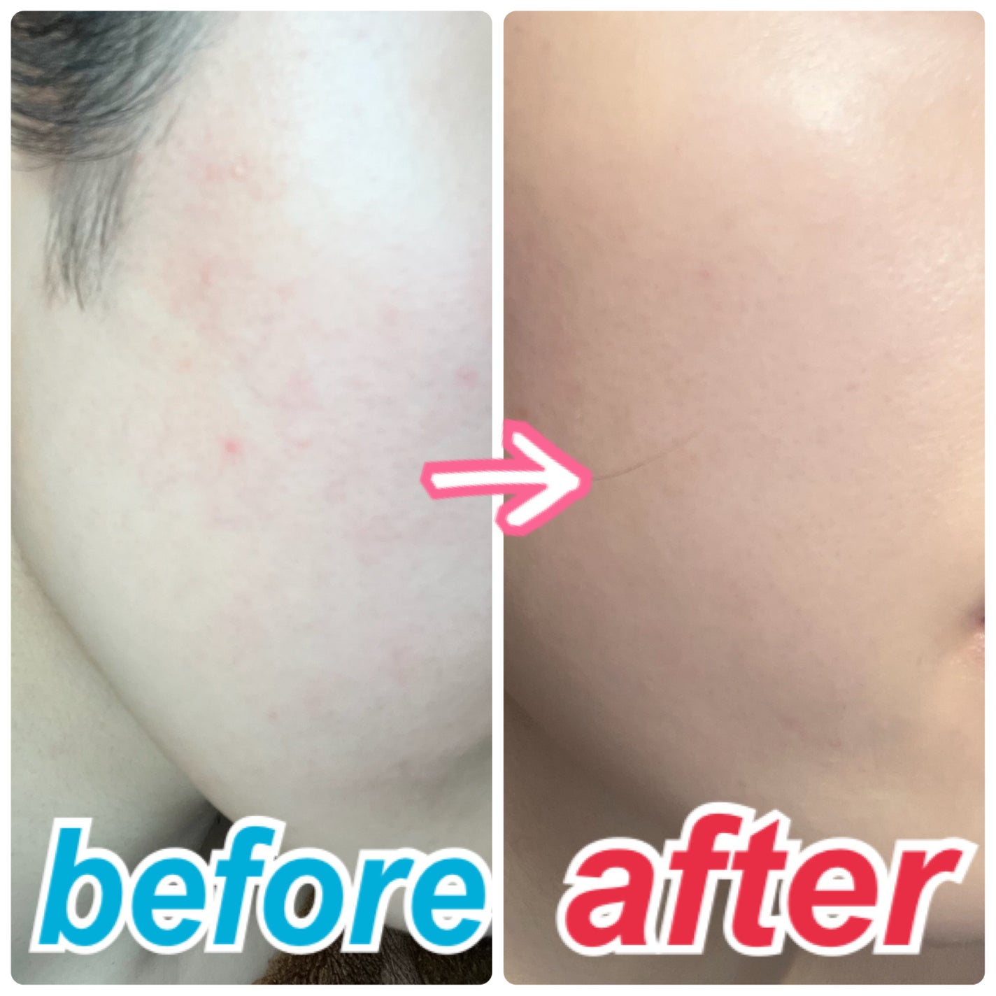 プリズム・リーブル/GIVENCHY/ルースパウダーを使ったクチコミ(3枚目)