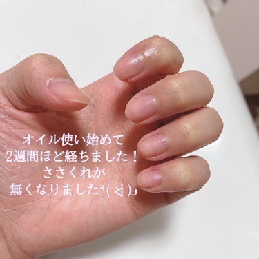 and U NAIL OILのクチコミ「ネイルオイル始めました(*⃙⃘´꒳`*⃙⃘)


こんにちは。ゆっちゃん。です。


みなさん.....」（3枚目）