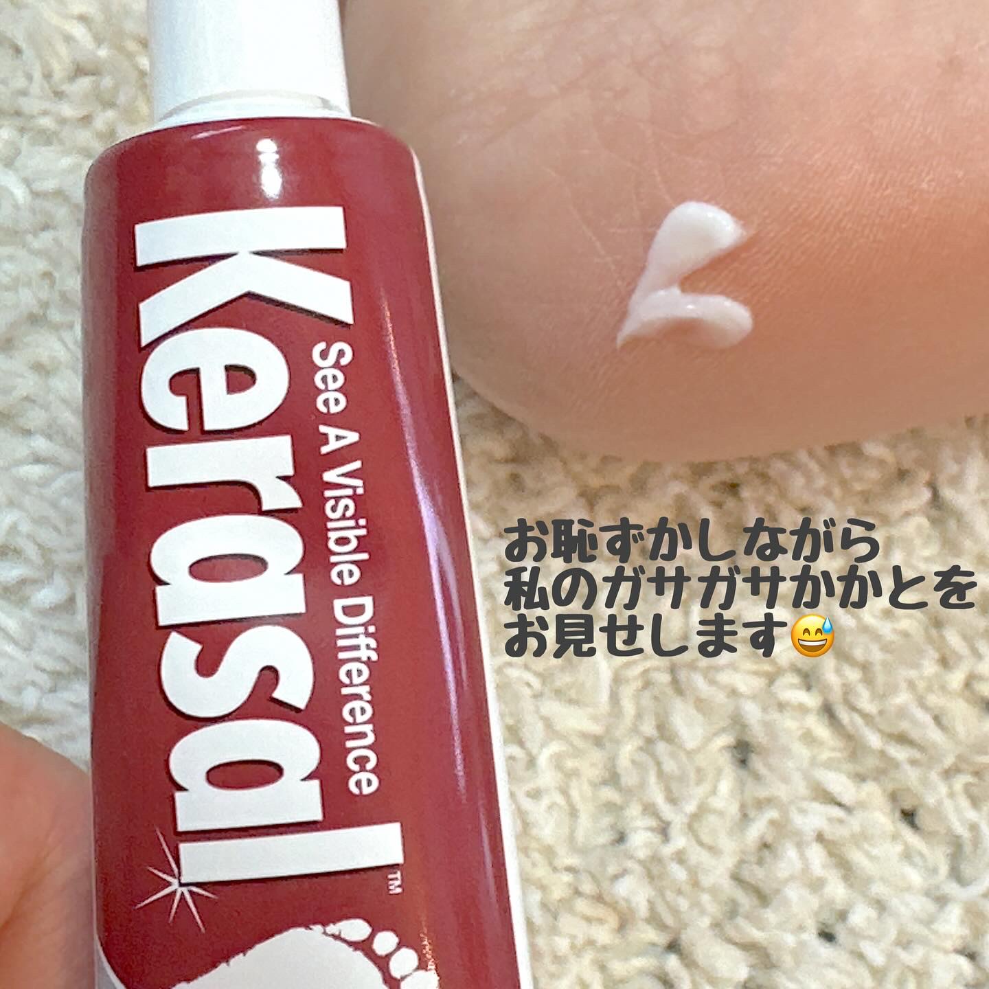 インテンシブフットリペア/Kerasal/レッグ・フットケアを使ったクチコミ（2枚目）