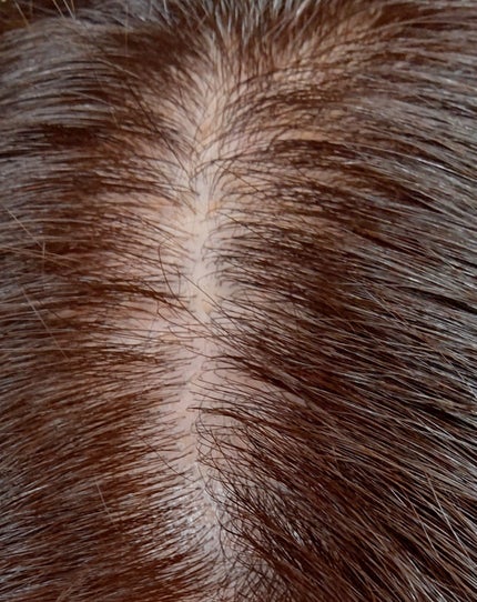 スカルプローション/Rintor/頭皮ローションを使ったクチコミ(2枚目)