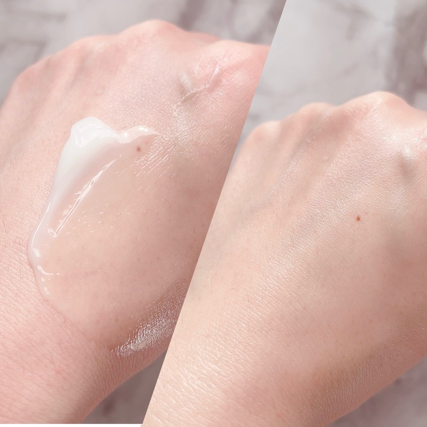 ビタプル リペア エッセンスローション/VITAPURU/化粧水を使ったクチコミ(5枚目)