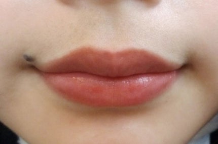 モアリップ N (医薬品)/資生堂薬品/その他を使ったクチコミ(3枚目)