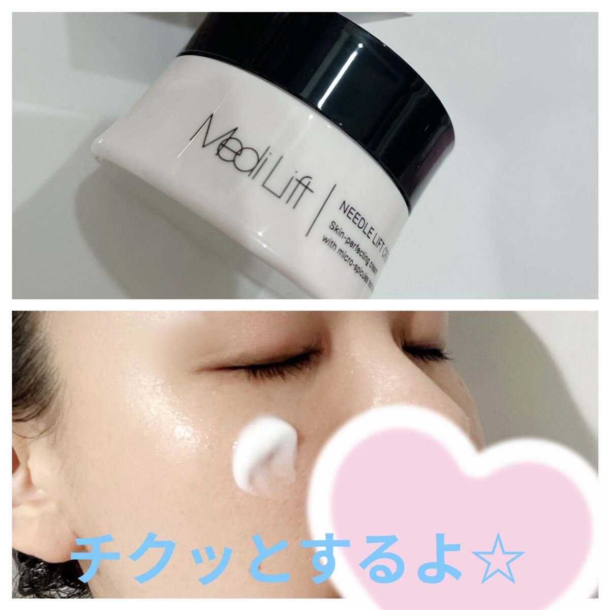 メディリフト ニードルリフトクリーム/YA-MAN TOKYO JAPAN/フェイスクリームを使ったクチコミ（3枚目）