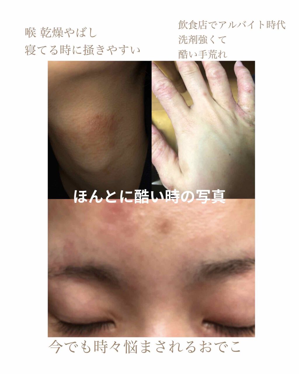 化粧水・敏感肌用・高保湿タイプ/無印良品/化粧水を使ったクチコミ(2枚目)