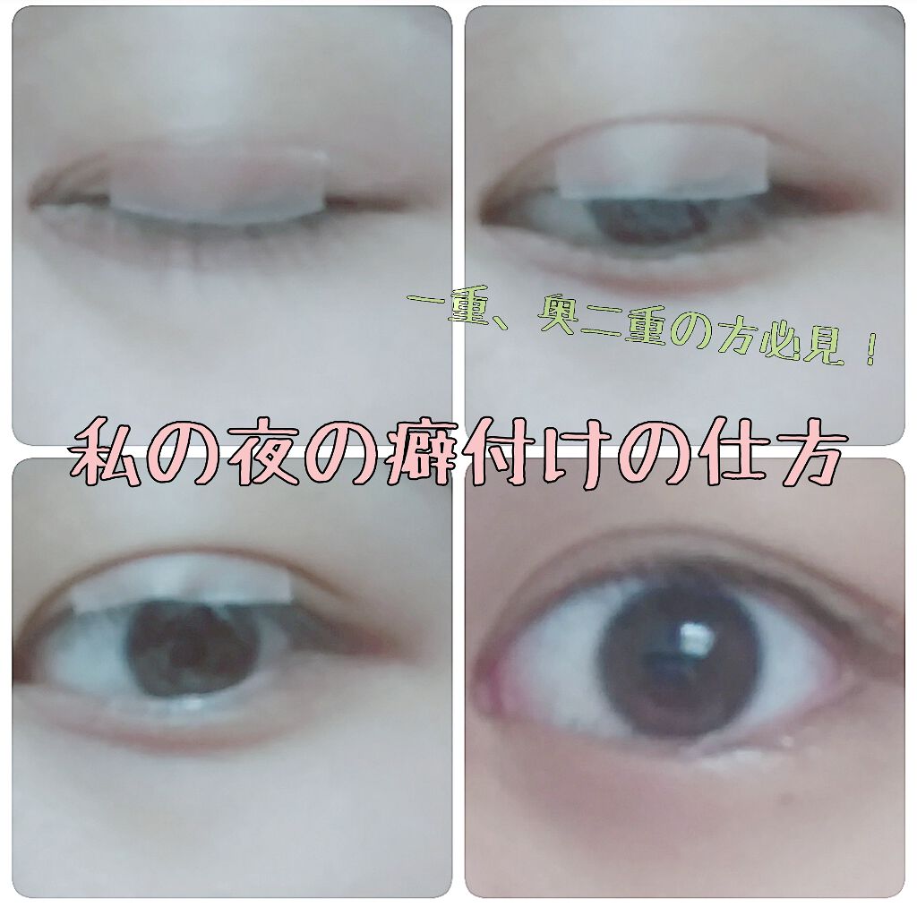 絆創膏/その他を使ったクチコミ（1枚目）