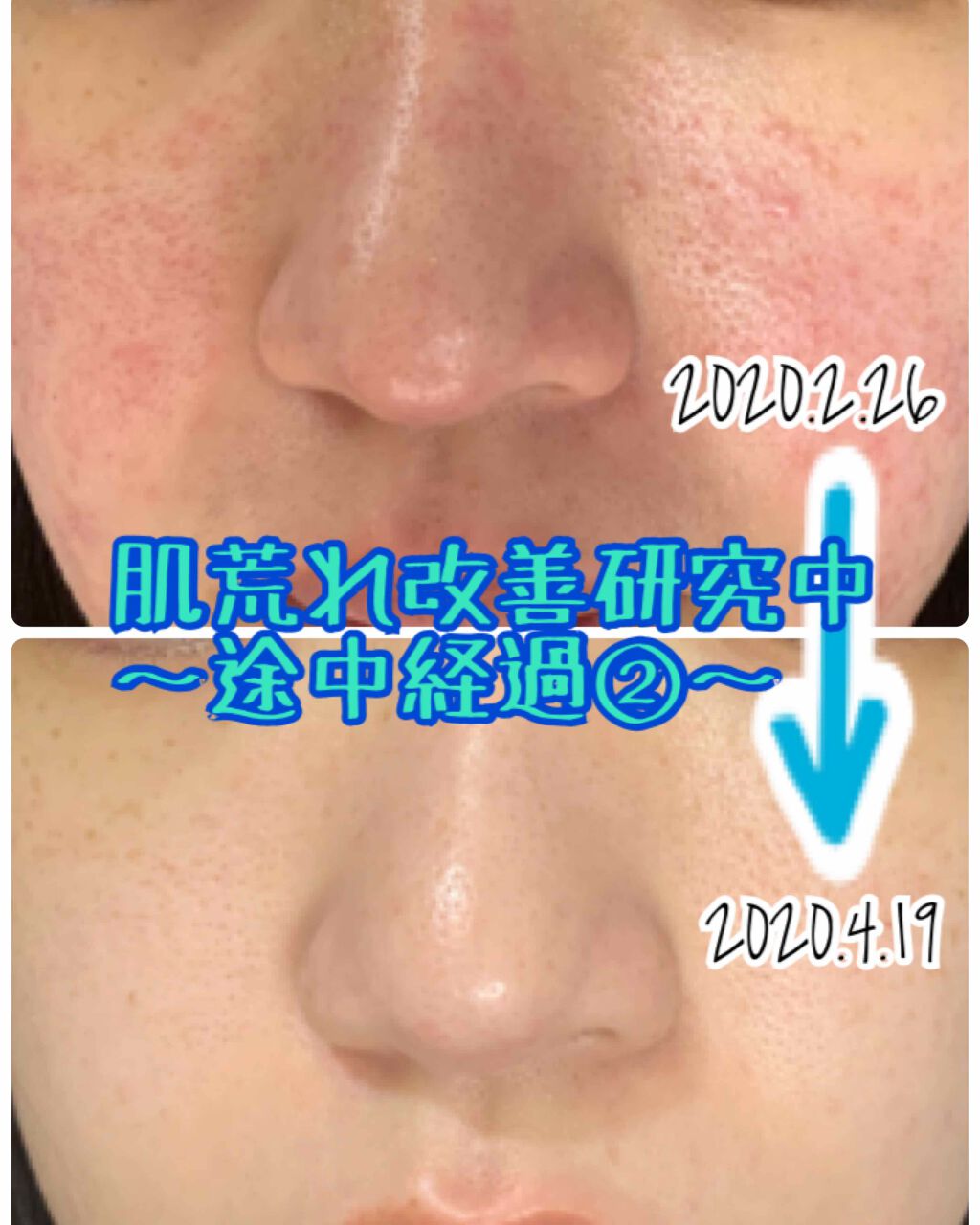 キールズ エッセンス ジェルマスク CL/Kiehl's/洗い流すパック・マスクを使ったクチコミ(1枚目)