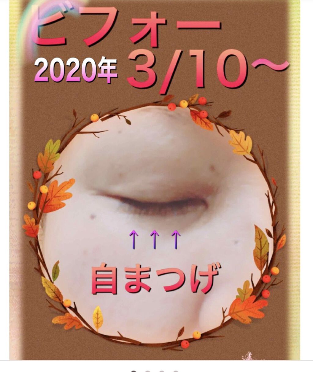 ひとえ・奥ぶたえ用カーラー/アイプチ®/ビューラーを使ったクチコミ（3枚目）