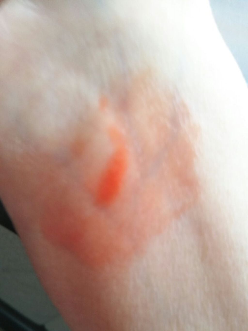 リップフォンデュ/メンソレータム/リップバームを使ったクチコミ(5枚目)