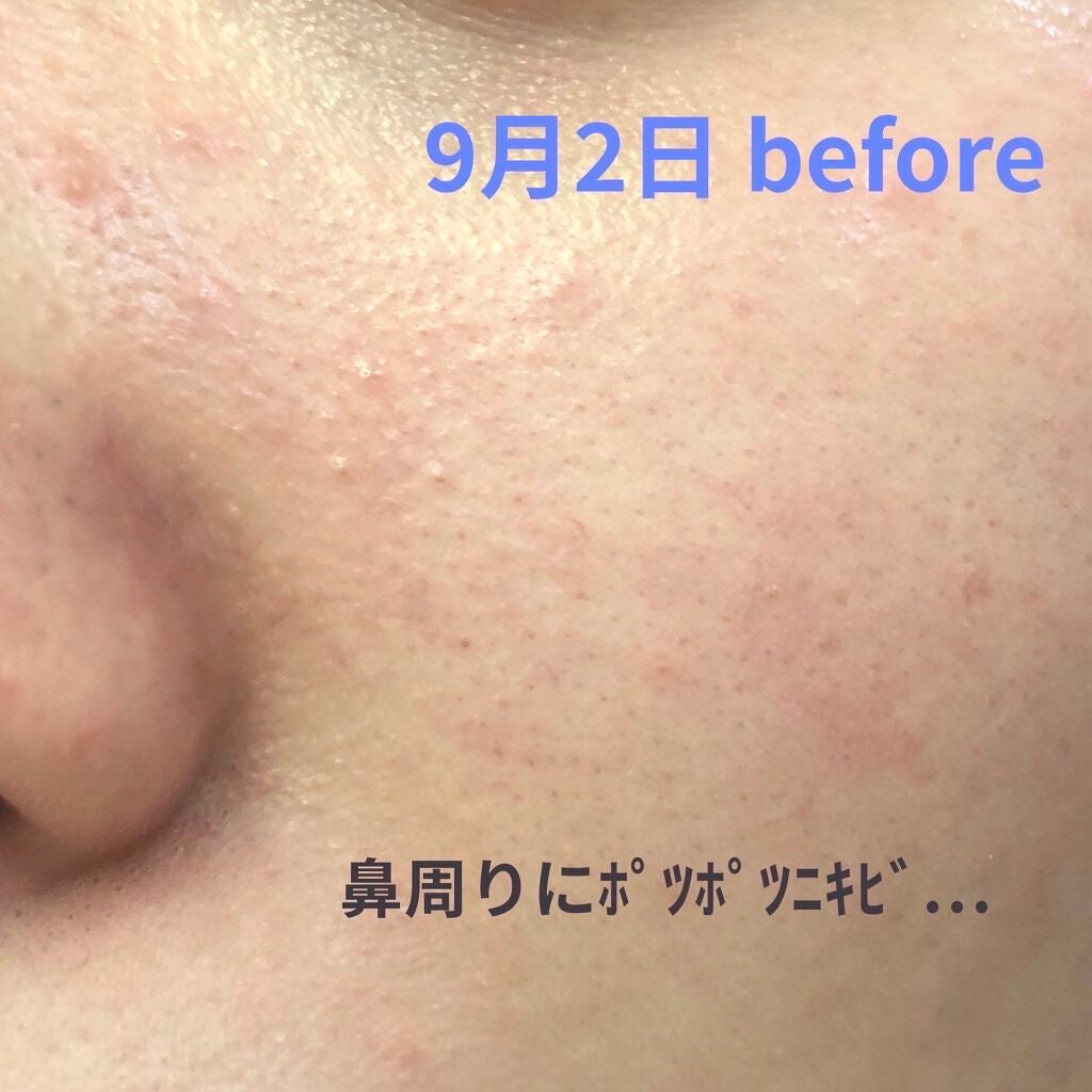 導入化粧液/無印良品/ブースター・導入液を使ったクチコミ(6枚目)