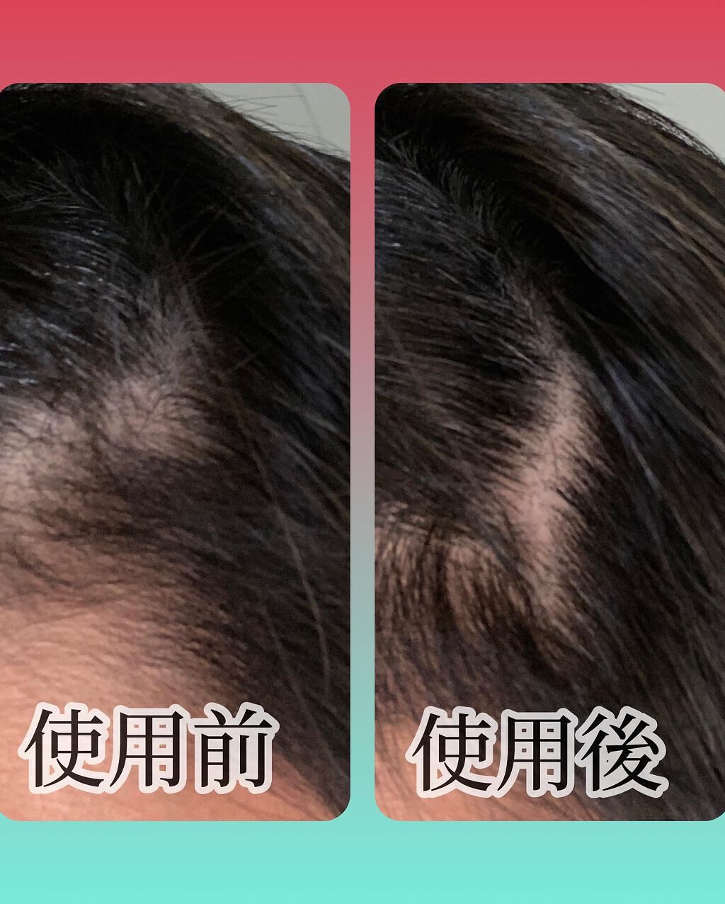 クロヴィア カラートリートメント/ルルシア/洗い流すヘアトリートメントを使ったクチコミ(7枚目)