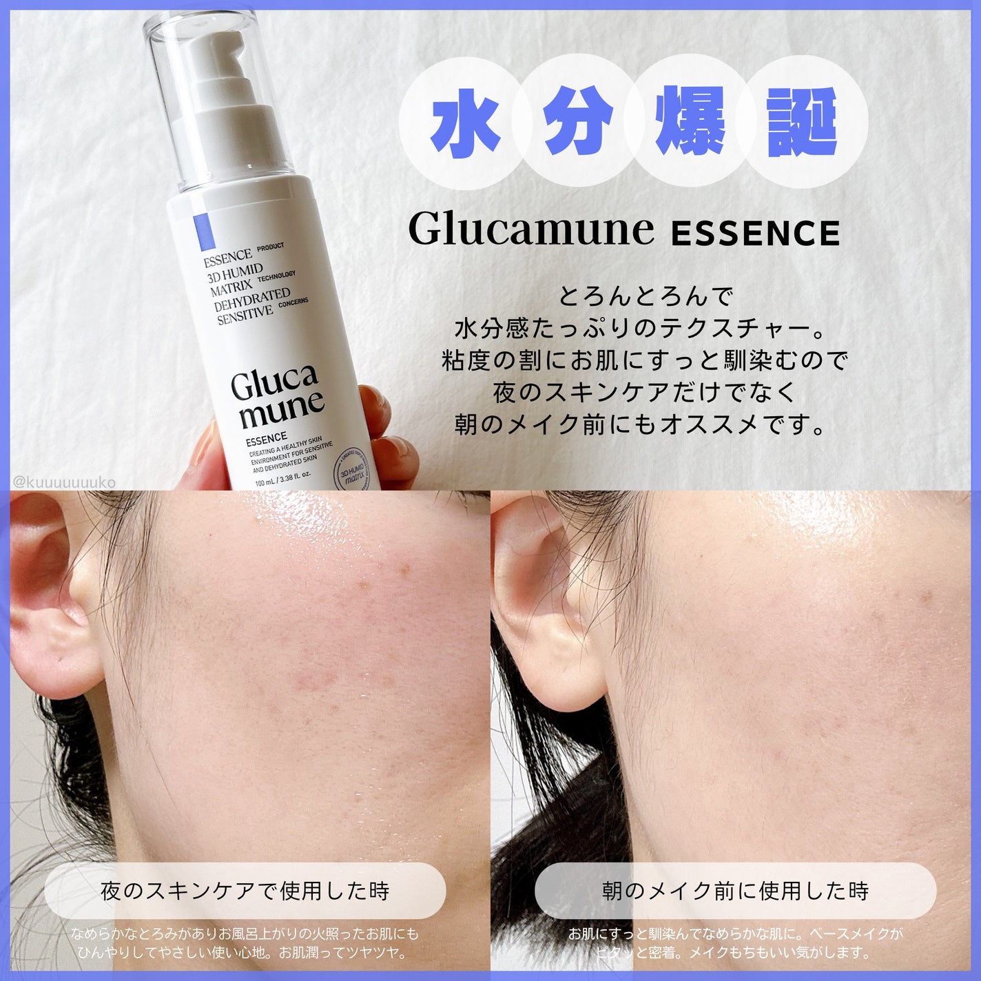 グルカミューンエッセンス /VT/美容液を使ったクチコミ(2枚目)