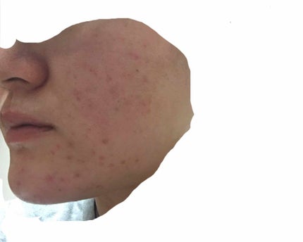 ビジャ クレンジングジェル/innisfree/クレンジングジェルを使ったクチコミ(2枚目)