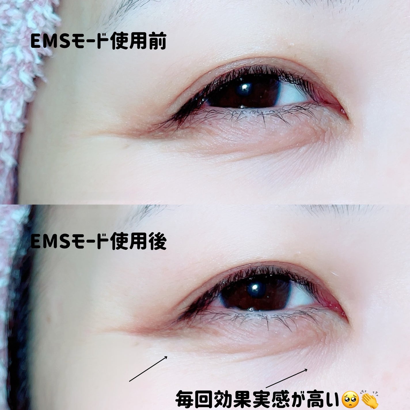 グルタチオングロウアンプル/MEDICUBE/美容液を使ったクチコミ(5枚目)