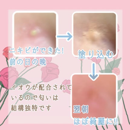 エスカメル(医薬品)/佐藤製薬/その他を使ったクチコミ(2枚目)