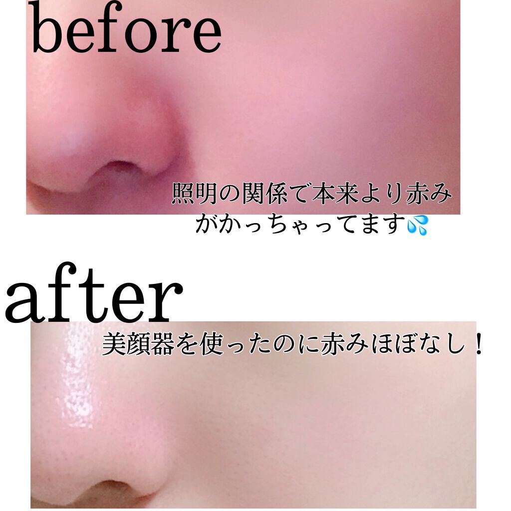 薬用スキンコンディショナー/オードメディカ/ボディローションを使ったクチコミ(2枚目)