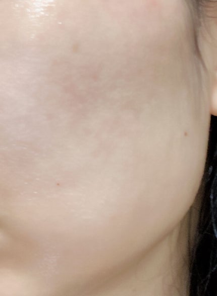 ダブル セーラム EX/CLARINS/美容液を使ったクチコミ(3枚目)