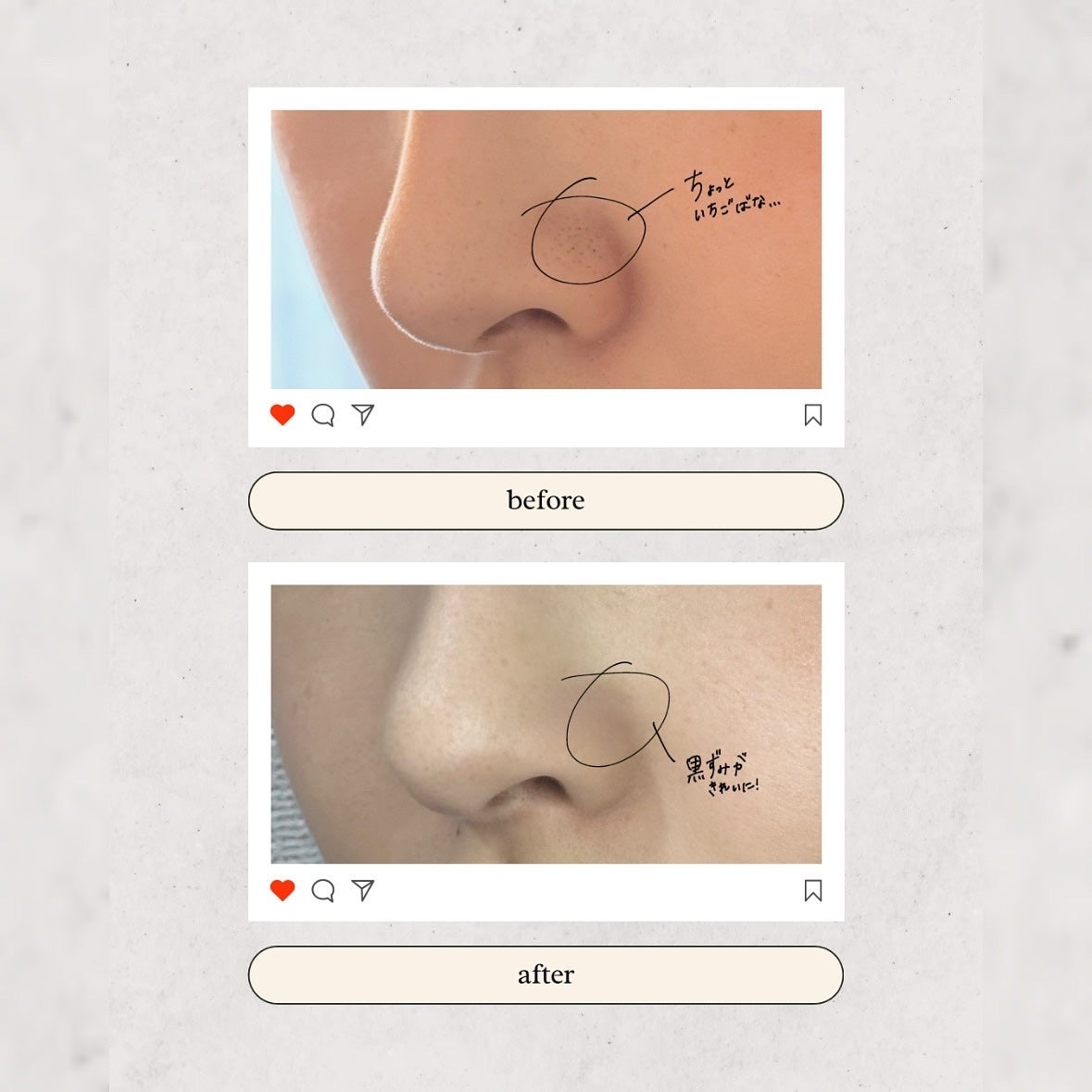 Hoshinað«ãã©ãã100ð« on LIPS ããã¡ã錻ãšã¯ããããªãðéåœãªãªãŒãã€ã³ã°ç¬¬äžäœã«ãèŒãããã..ãïŒ4æç®ïŒ