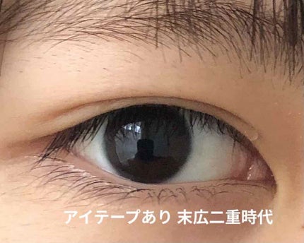 のびーるアイテープ(絆創膏タイプ、レギュラー)/DAISO/二重まぶた用アイテムを使ったクチコミ(3枚目)