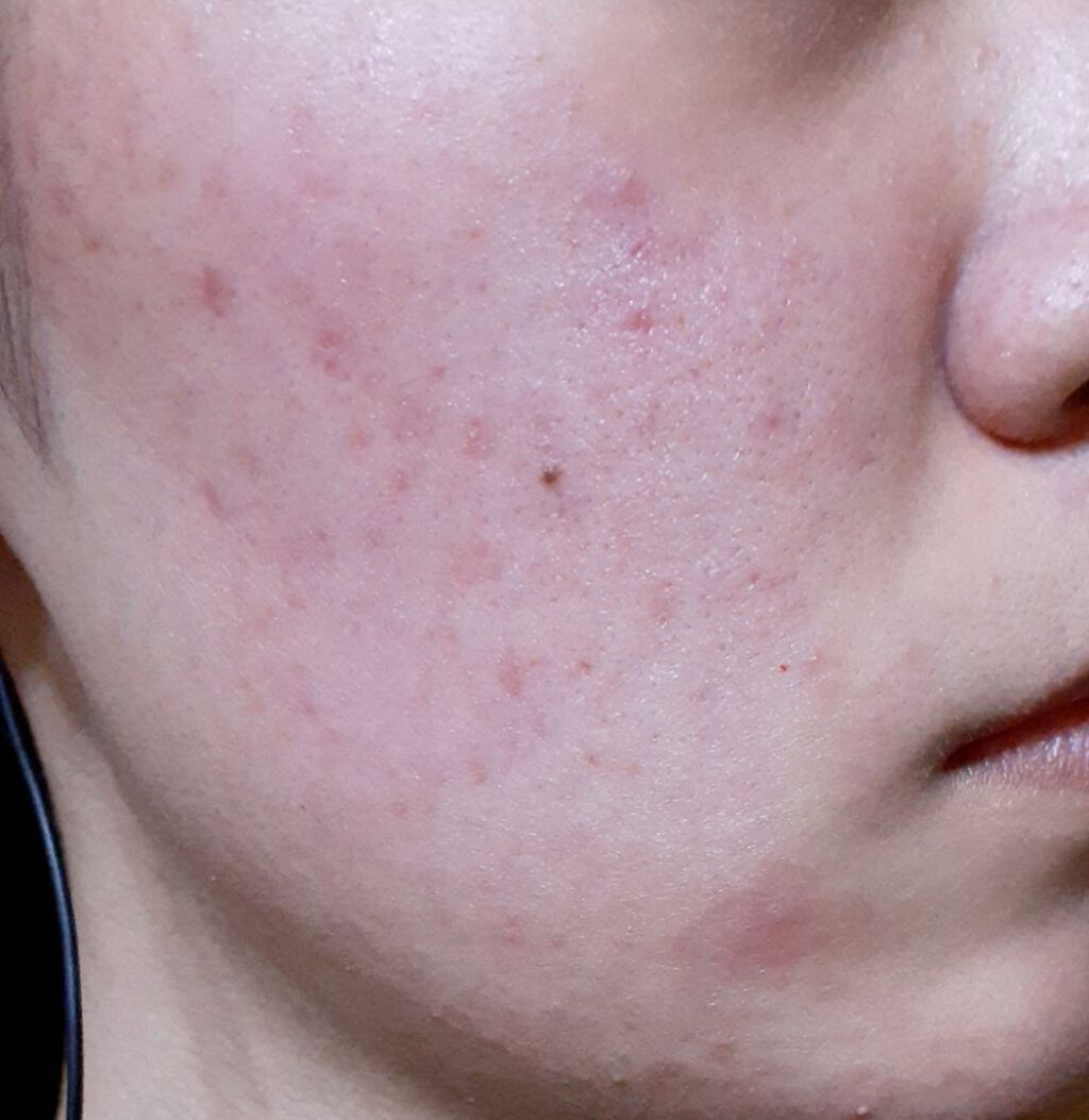 乳液・敏感肌用・さっぱりタイプ/無印良品/乳液を使ったクチコミ(1枚目)