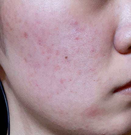 乳液・敏感肌用・さっぱりタイプ/無印良品/乳液を使ったクチコミ(1枚目)