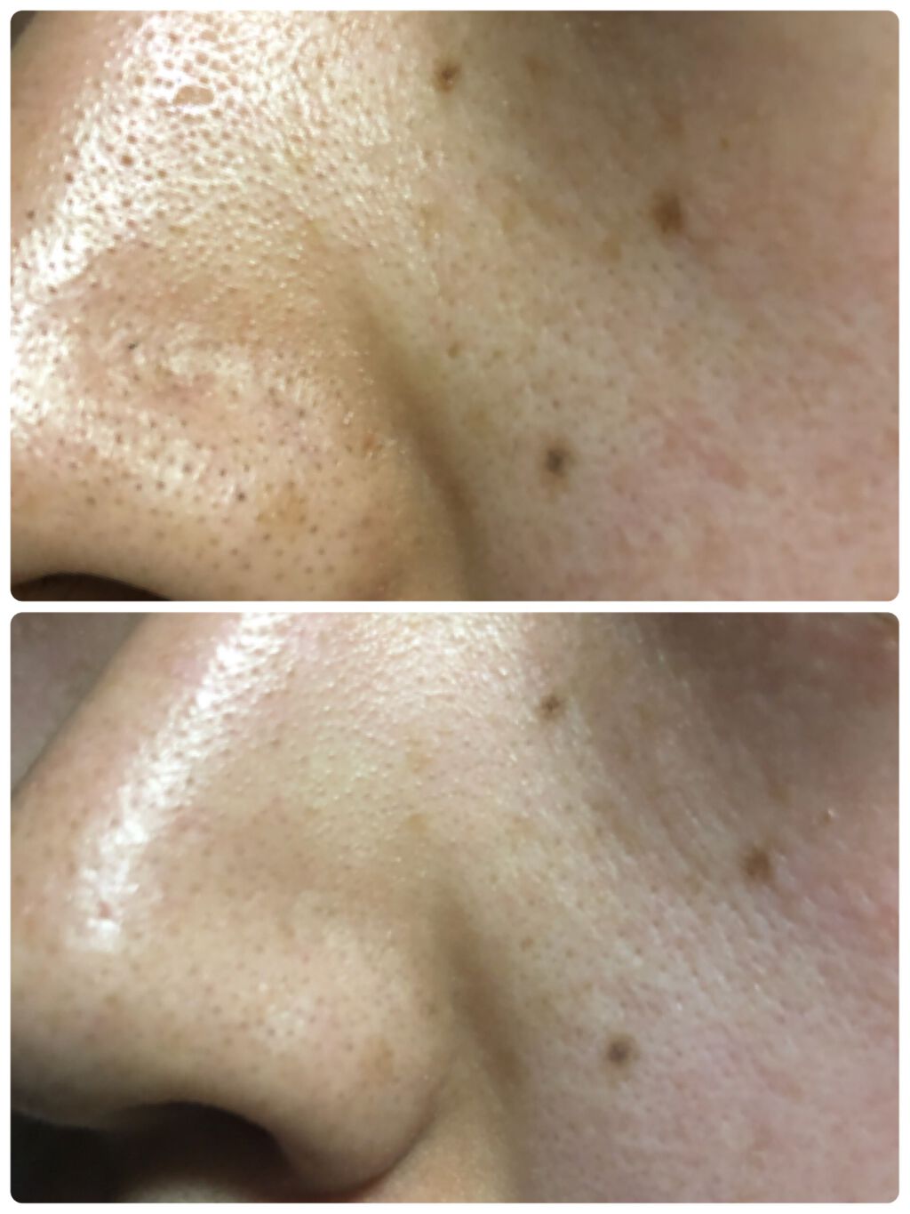 クリアプロ クレンジングバーム ホワイト/ソフティモ/クレンジングバームを使ったクチコミ(2枚目)