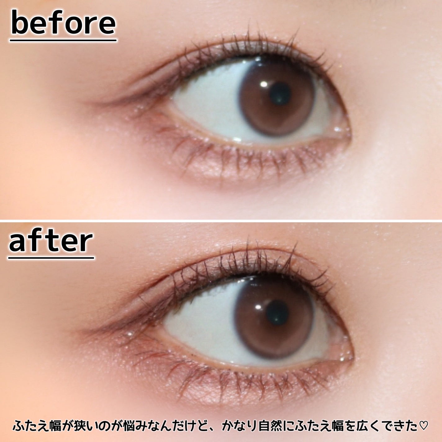 メザイク クリップ カッター ファイバー専用カッター/メザイク/二重まぶた用アイテムを使ったクチコミ(9枚目)