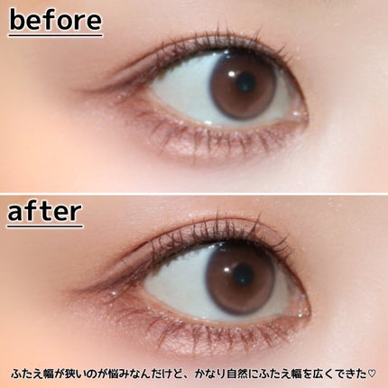 メザイク クリップ カッター ファイバー専用カッター/メザイク/二重まぶた用アイテムを使ったクチコミ(9枚目)