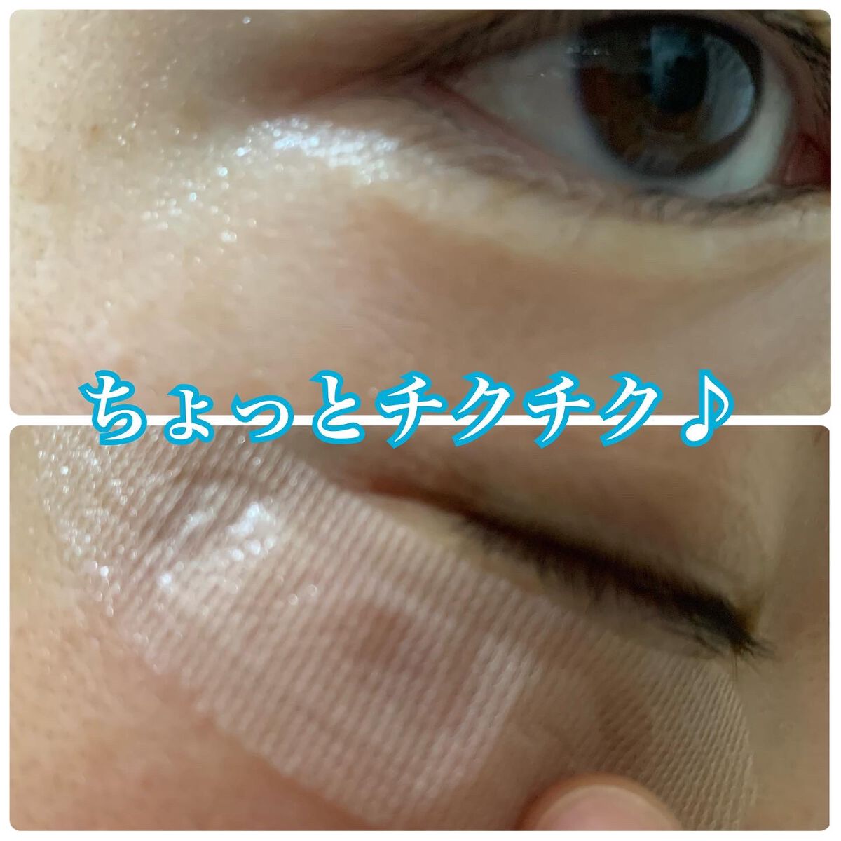 ☆scallop☆フォロバ100%☆ on LIPS 「パッチを貼り付けると、マイクロニードルが溶けだして美容成分がじ..」(4枚目)