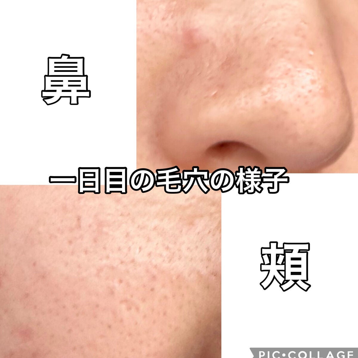 ミシャ ビタシープラス デイリーマスク【日本処方】/MISSHA/シートマスク・パックを使ったクチコミ(9枚目)