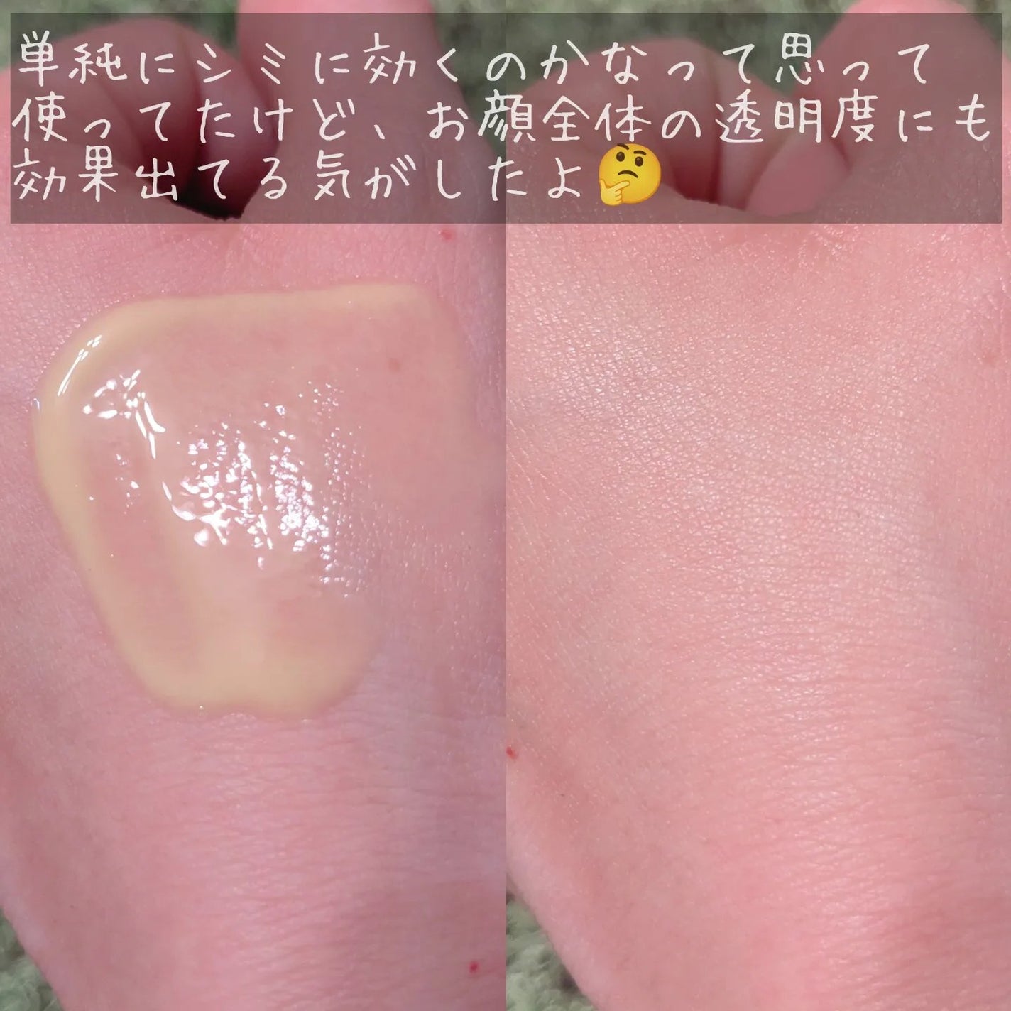 ディープビタCアンプル2.0/MEDICUBE/美容液を使ったクチコミ(5枚目)