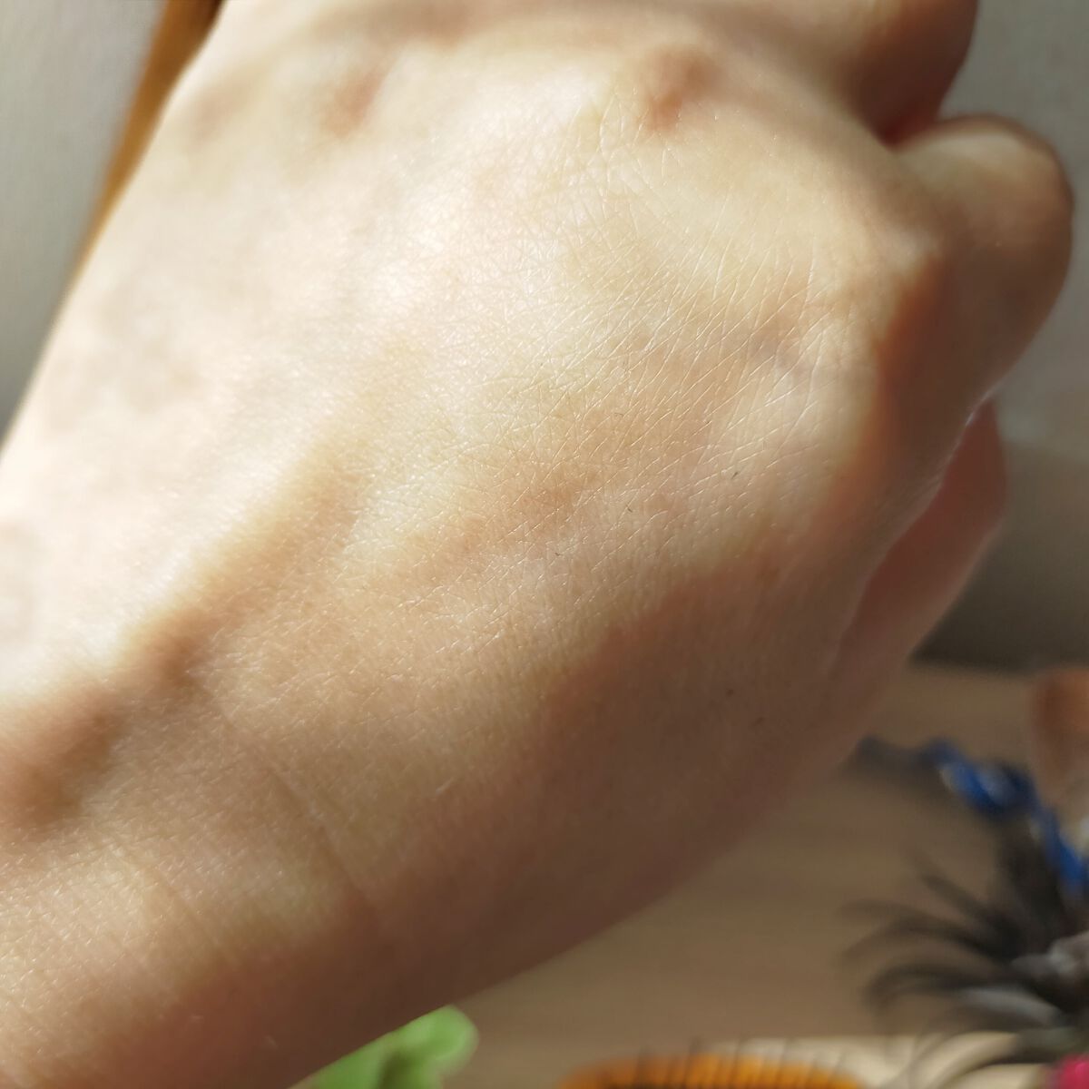 薬用マイクロバブルローション/Macchia Label/化粧水を使ったクチコミ（3枚目）