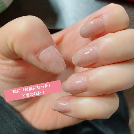 さ on LIPS 「深爪・チビ爪矯正日記🤞私自身ずっと爪を噛むクセがあって大学入っ..」(4枚目)