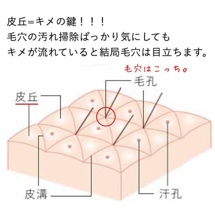 おゆみ|ニキビ・ニキビ跡ケア on LIPS 「毛穴は汚れているから目立つという誤解🙅♀️🙅♀️毛..」(4枚目)