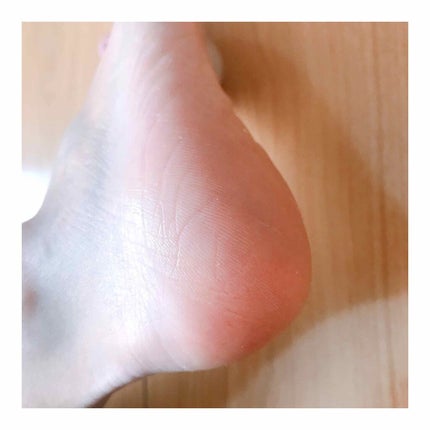 Dr.セーム 洗顔ミトン/アレトコレ/その他スキンケアグッズを使ったクチコミ(4枚目)