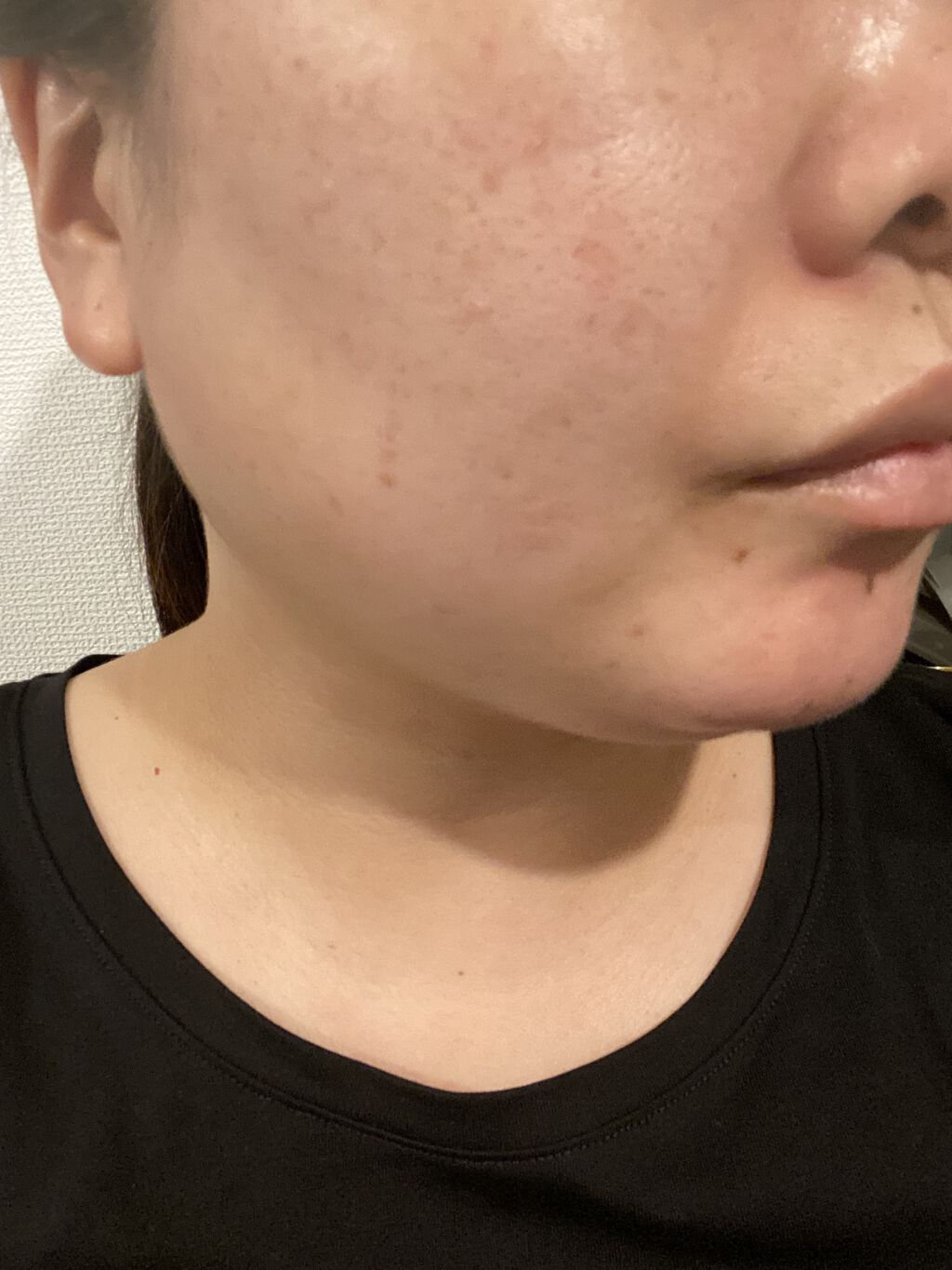 ダーマラックローション/エンビロン/ボディローションを使ったクチコミ（3枚目）