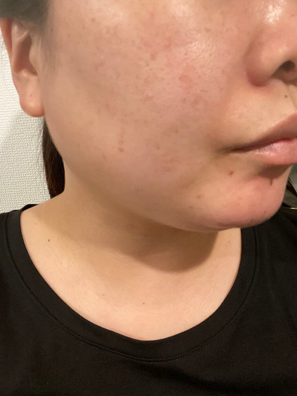 ダーマラックローション/エンビロン/ボディローションを使ったクチコミ(3枚目)