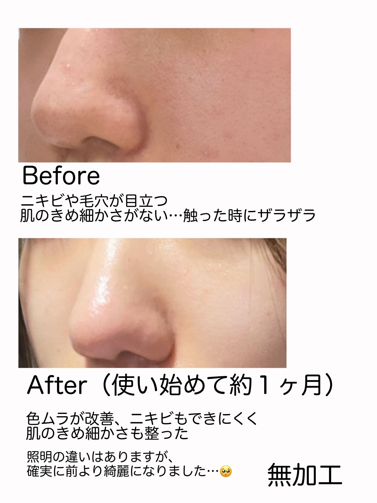 極潤 薬用ハリ化粧水【医薬部外品】/肌ラボ/化粧水を使ったクチコミ（2枚目）