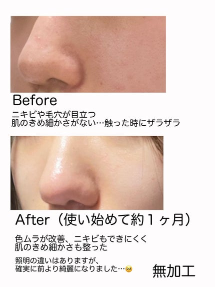 極潤 薬用ハリ化粧水【医薬部外品】/肌ラボ/化粧水を使ったクチコミ(2枚目)