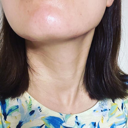 極薄透明パッチ nikipa!/金冠堂/にきびパッチを使ったクチコミ(3枚目)